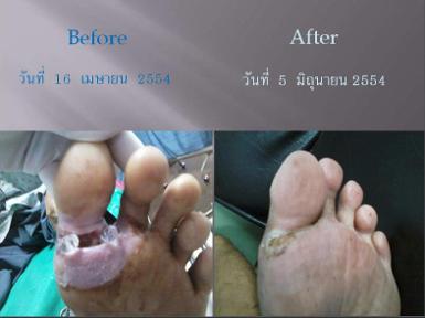 ทาน Maqi berry